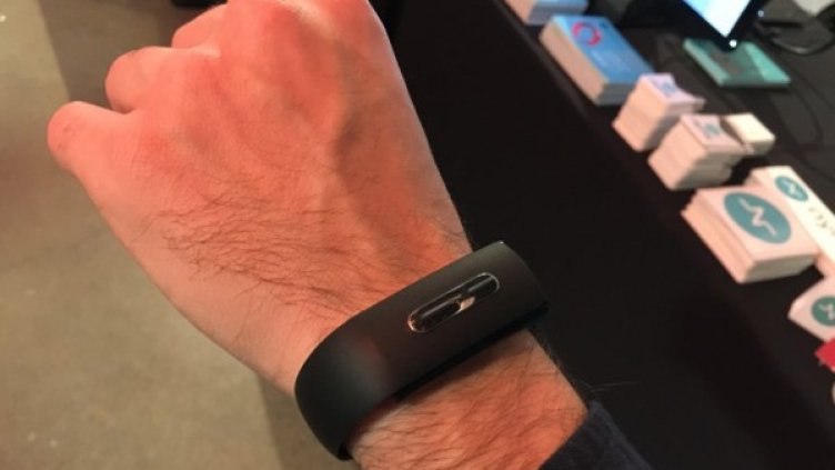 Снимка: Bionym