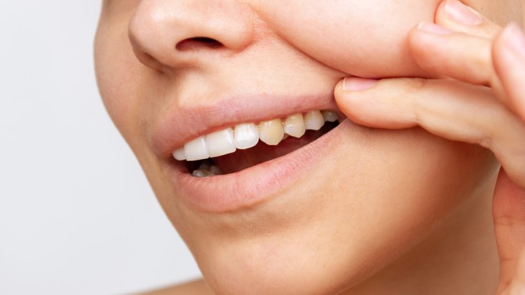 Снимка: iStock