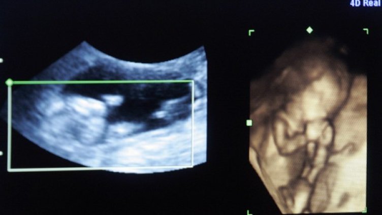 Снимка: Reuters, архив