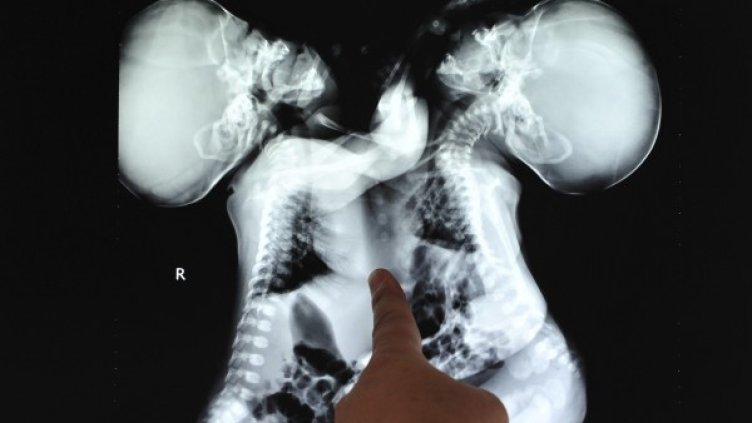 Снимка: Reuters, архив