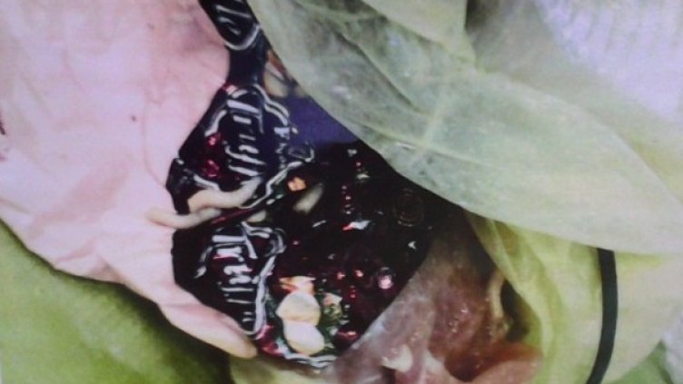 Пламен Моллов показа снимка, която според него доказва, че в преработваното от компанията месо са открити червеи. Снимка: БАБХ