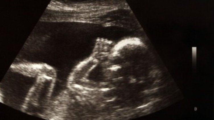 Снимка: Flickr