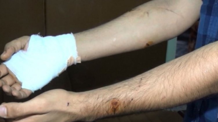 Нахапаният работник. Снимка: Dnes.bg