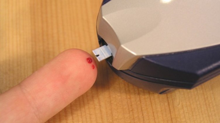 Снимка: freeimages.com