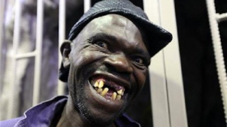 "Мистър Грозник" Зимбабве &ndash; беззъбо плашило (18+)