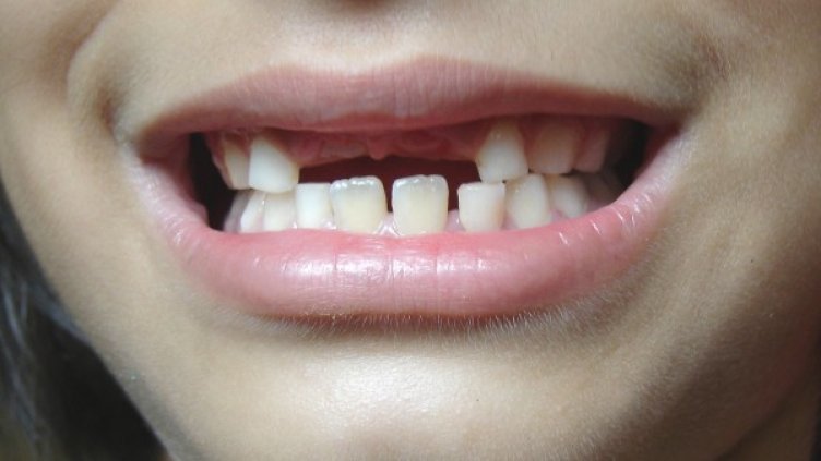 Снимка: flickr