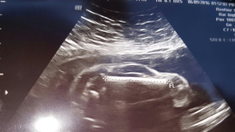 Снимка: Reddit