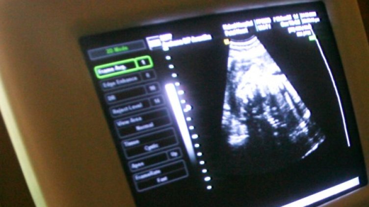 Източник: Reuters