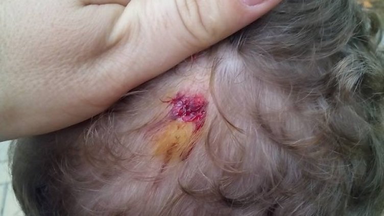 Майка на простреляно 2-годишно: "Благодаря" на лекари, полиция...