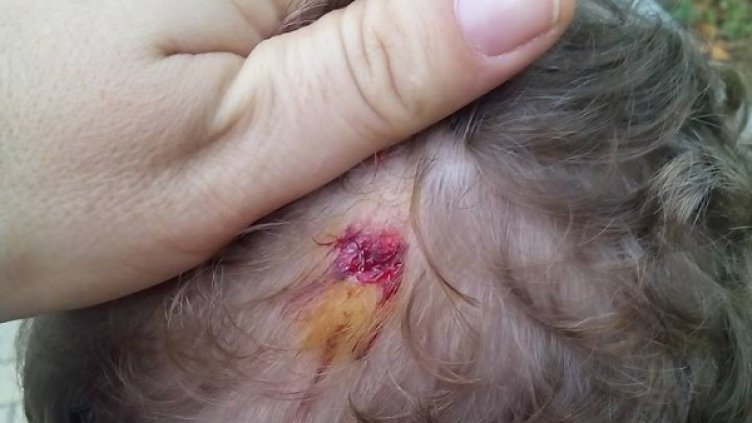 Раната на главата на момченцето. Снимка: Facebook