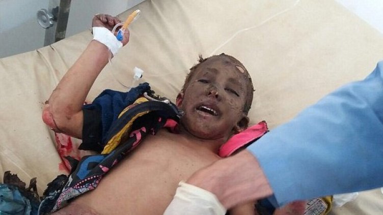 Не, не е Виетнам, а Сирия... Жертвите на напалма (18+)