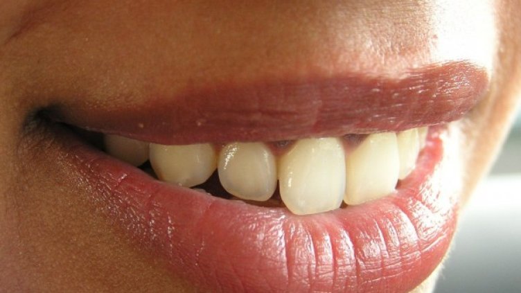 Снимка: freeimage