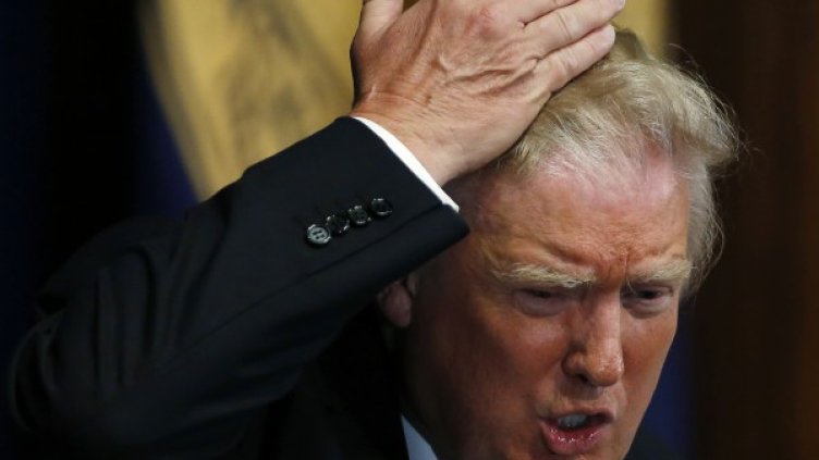 И тайната на гъстата коса на Тръмп е...