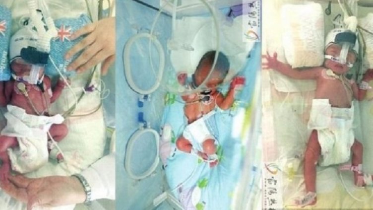 Снимка: med.news.am