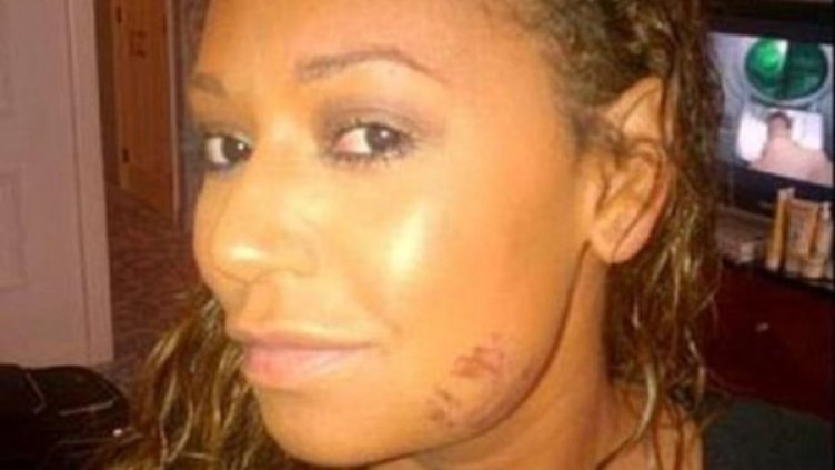 Снимка: DailyMail