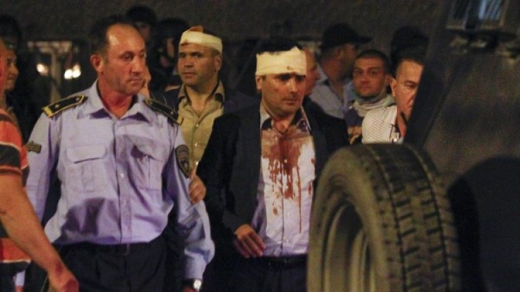 Раненият председател на Социалдемократическия съюз на Македония Зоран Заев. Снимка: Reuters