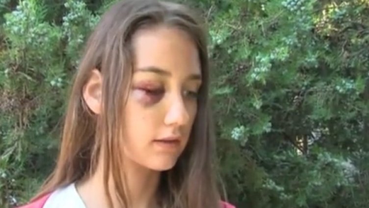 Пострадалото момиче. Кадър: bTV