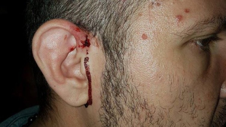 Нов ден, ново ромско насилие. Жертвата &ndash; българин, живеещ в Англия