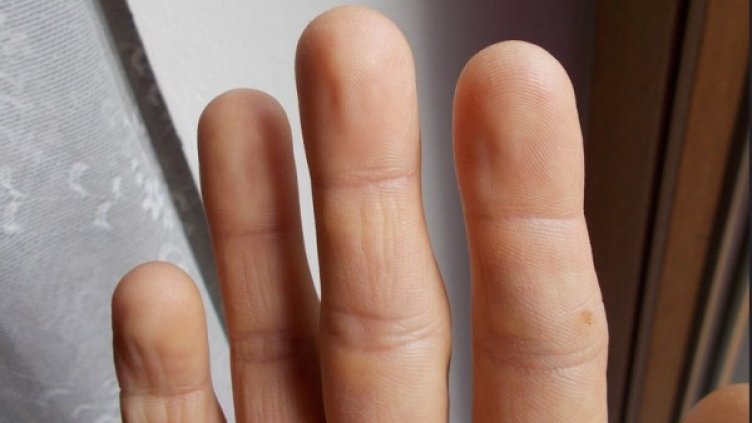 Снимка: flickr