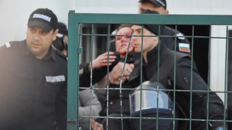 Ранената полицайка; Снимка: Булфото, архив