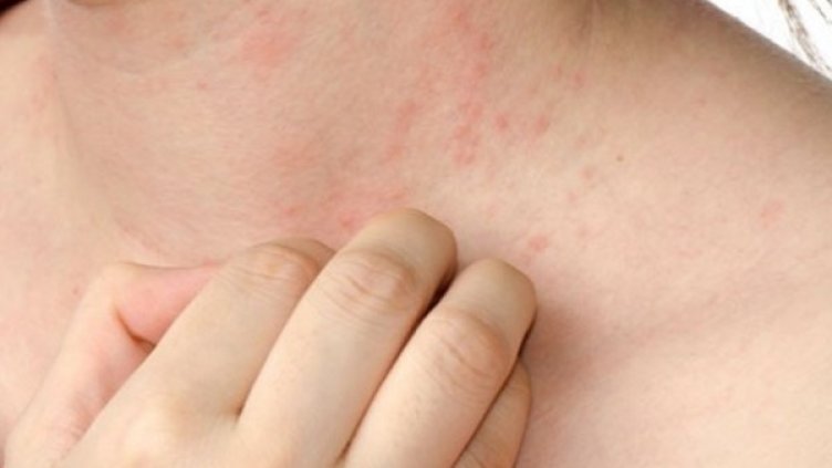 Снимка: flickr