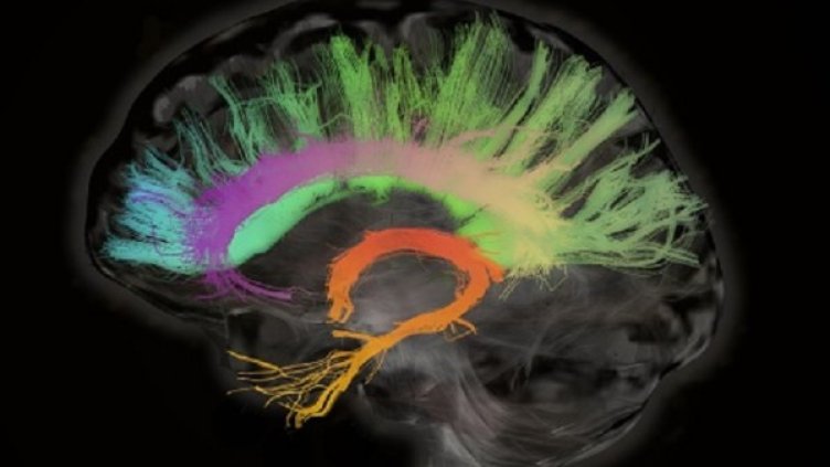 Снимка: Getty Images