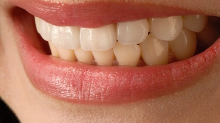 Снимка: Pixabay