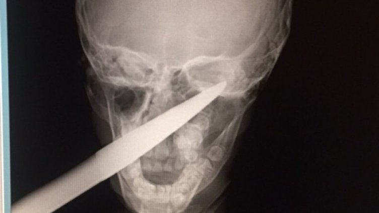 Снимка:  УМБАЛ Бургас