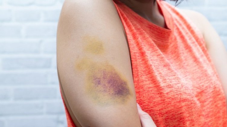 Снимка: istock