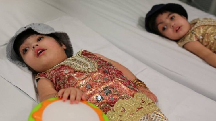 Снимка: Great Ormond Street Hospital