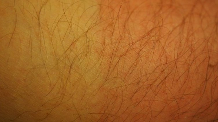 Снимка: Pixabay