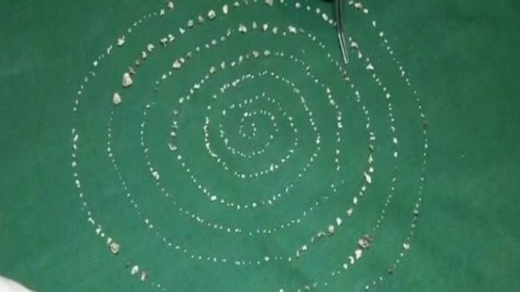 Снимка: Times of India