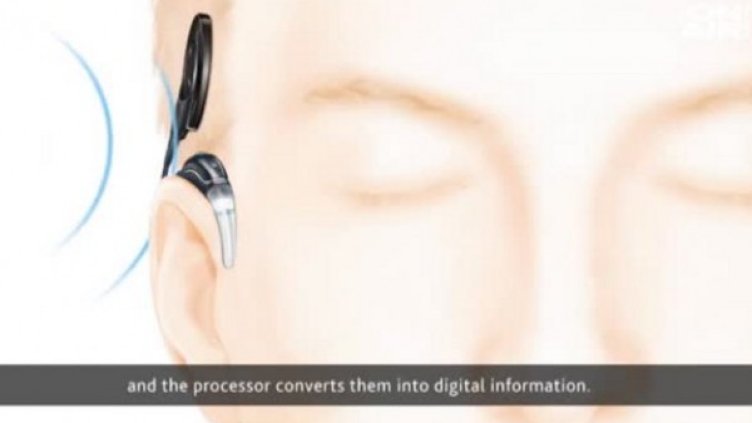 Вече 15 г. от ВМА връщат слуха на глухонеми 