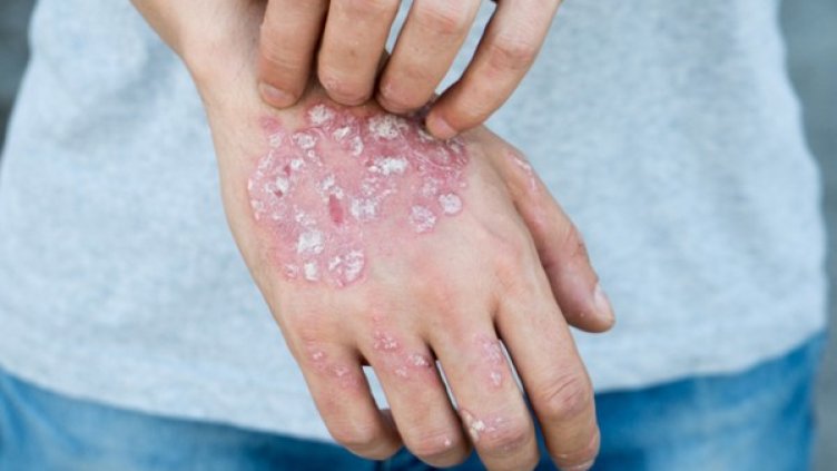 Снимка: istock