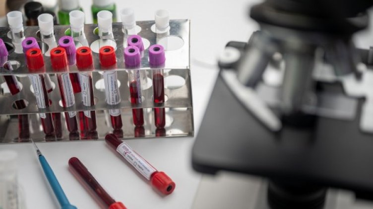 Снимка: Pixabay