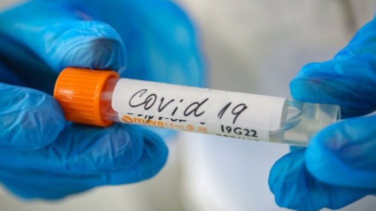 Китай дължал много отговори на въпроси за коронавируса 