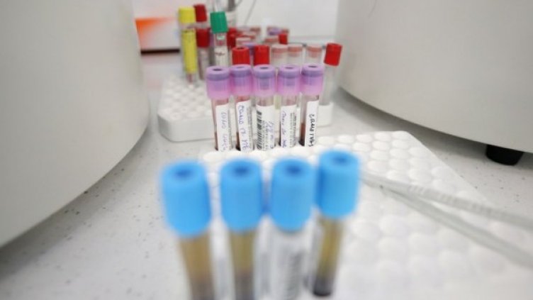 Личните лекари да назначават тестове за коронавирус