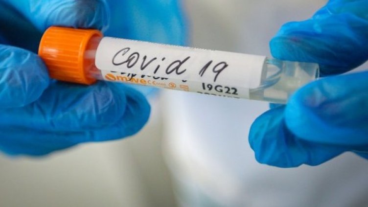 Коронавирусът прилича на ХИВ?