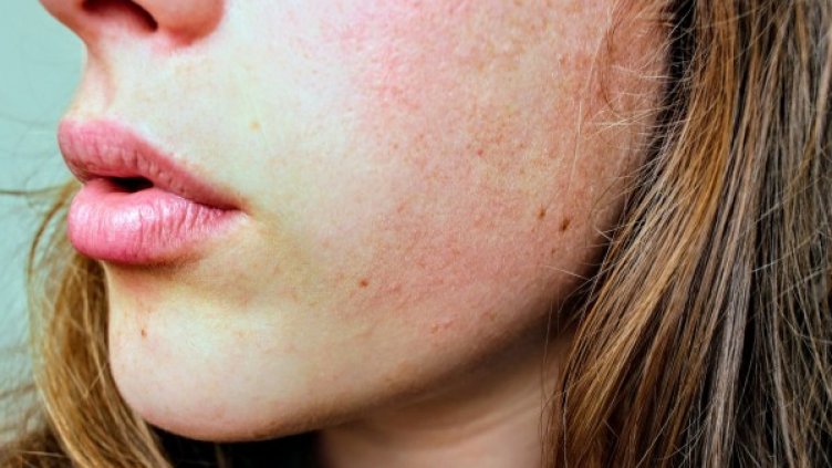 Снимка: Pexels