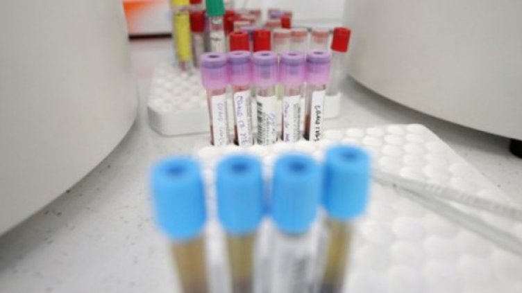 Руснак с коронавирус е настанен в МБАЛ - Шумен 