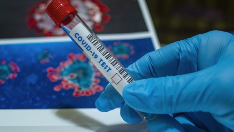 Снимка: Pixabay