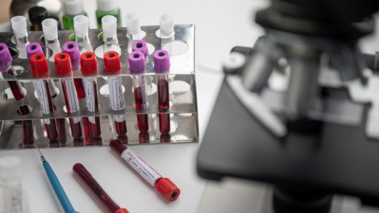 Снимка: Pixabay