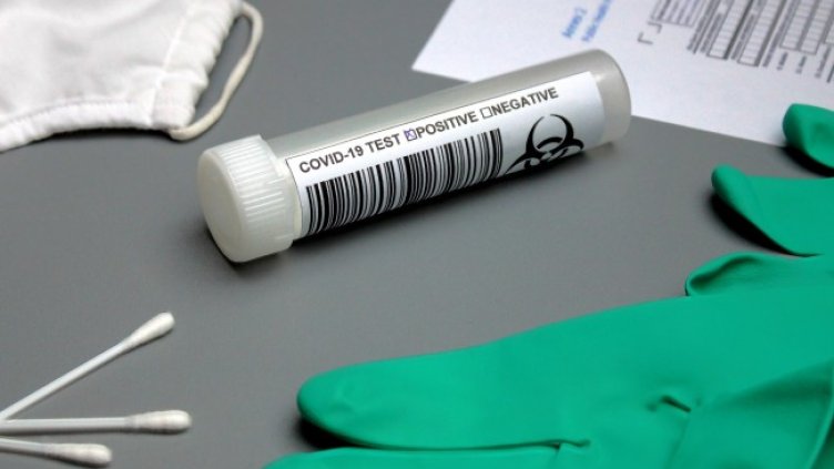 Снимка: Pixabay