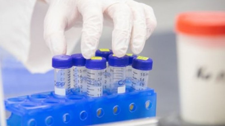 Кардиолог: Рядко човек би отключил заболяване след вируса