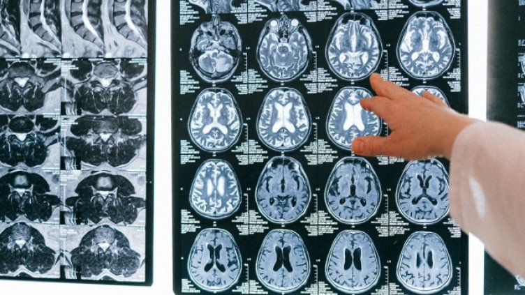 Снимка: pexels.com