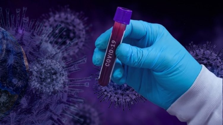 Снимка: Pixabay