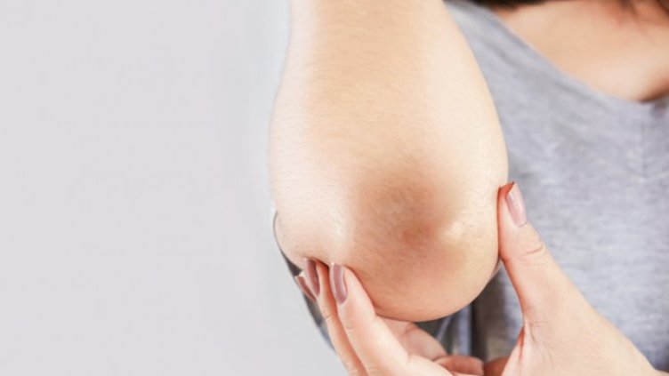 Снимка: Istock