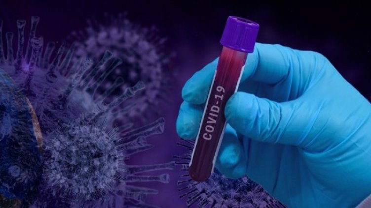 Снимка: Pixabay