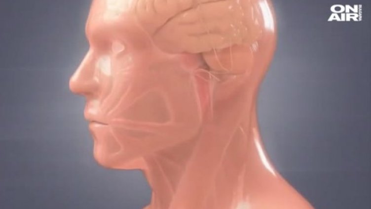 Как да разпознаем коварния менингит, маскиран като настинка