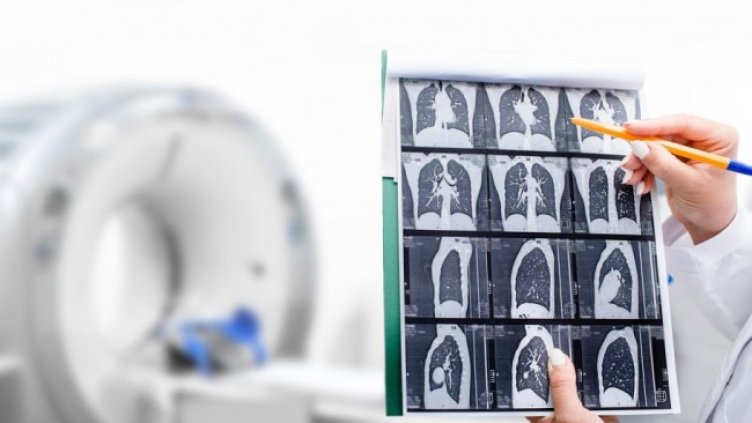 Снимка: iStockphoto